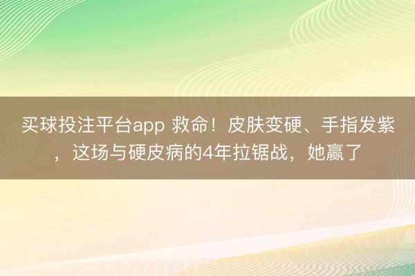 买球投注平台app 救命!皮肤变硬、手指发紫,这场与硬皮病的4年拉锯战,她赢了